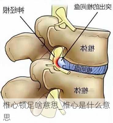 椎心顿足啥意思_椎心是什么意思