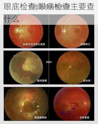 眼底检查,眼底检查主要查什么